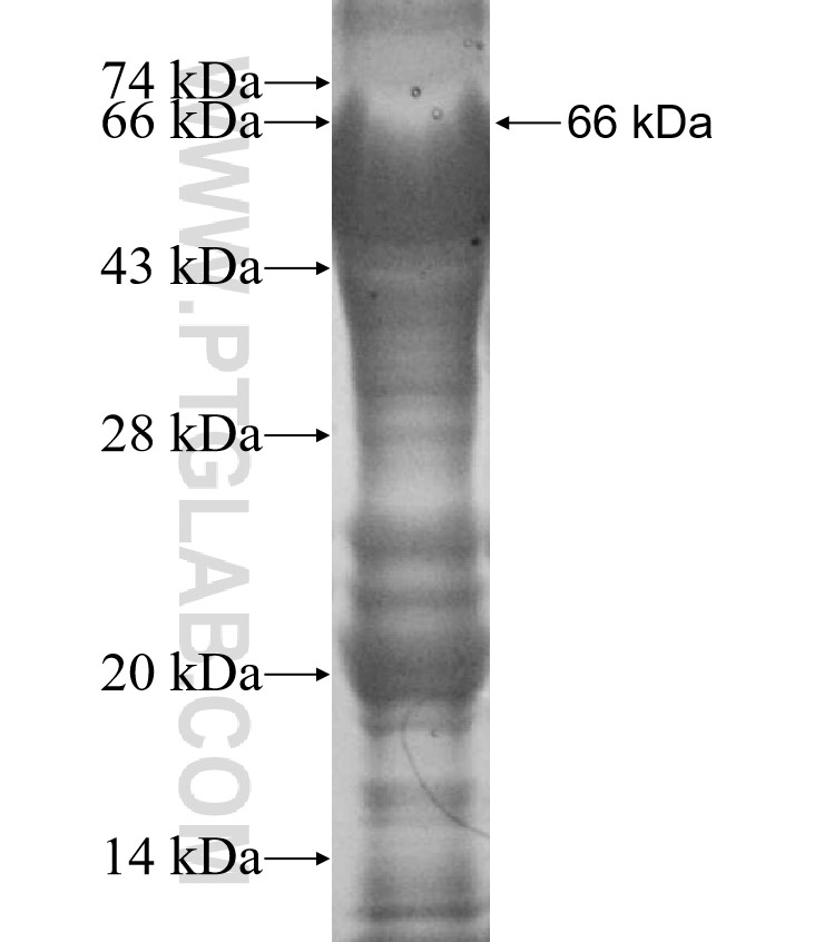 ACCN1 fusion protein Ag12301 SDS-PAGE