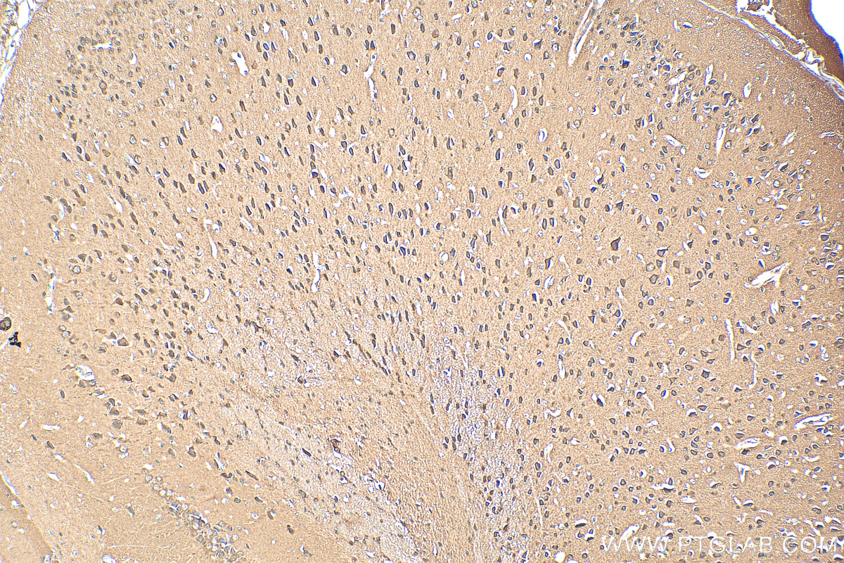IHC staining of mouse brain using 25356-1-AP