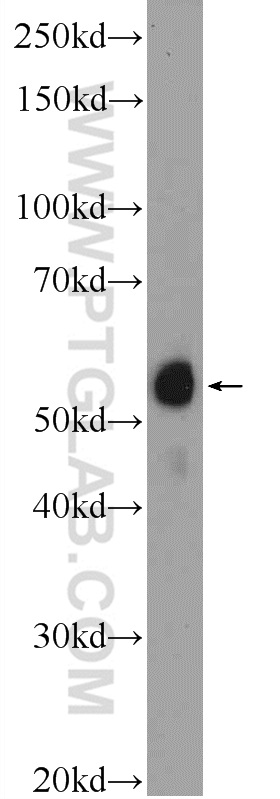 WB analysis of Jurkat using 25849-1-AP