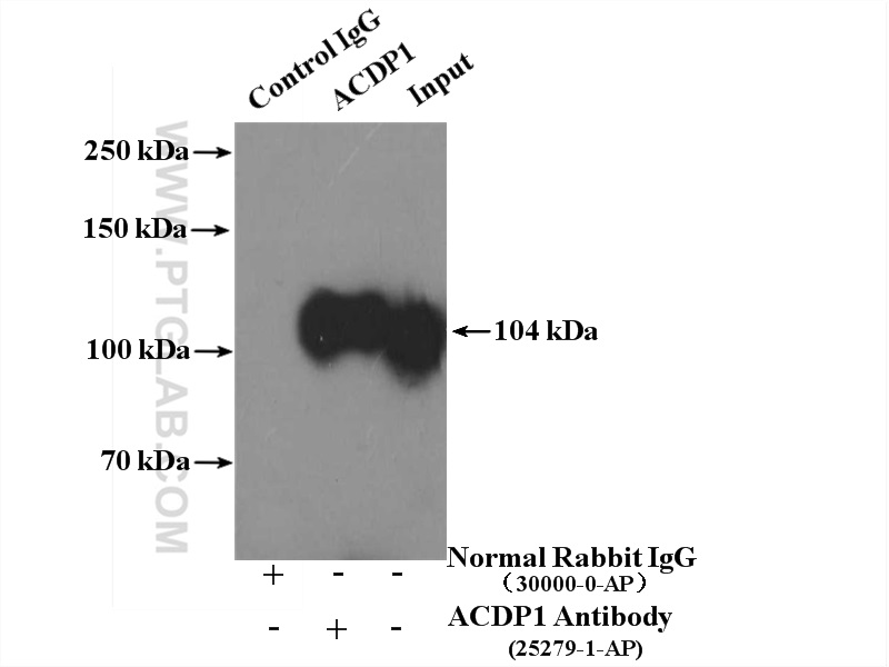 IP experiment of mouse brain using 25279-1-AP