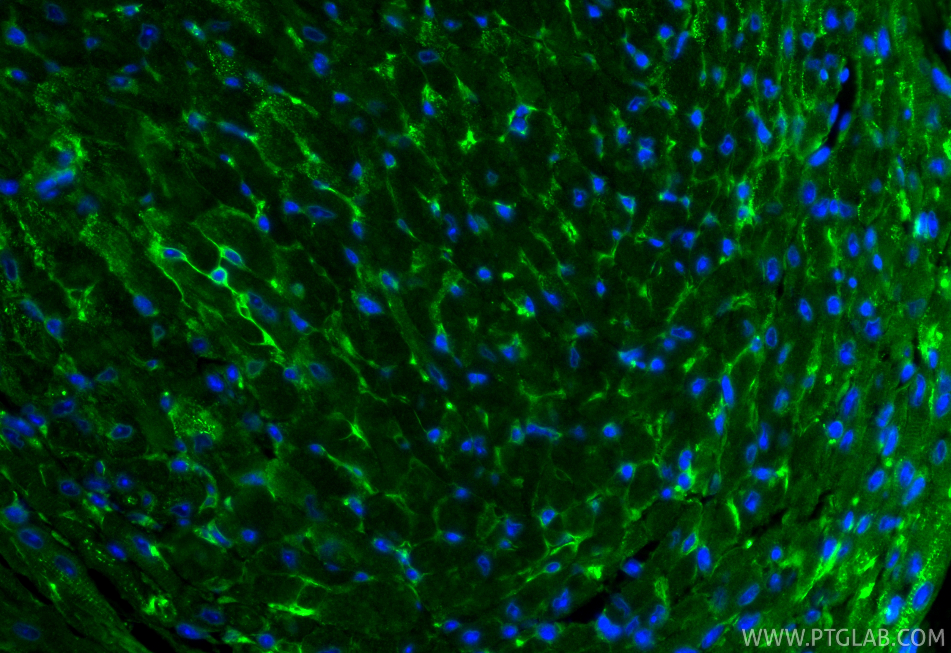 IF Staining of mouse heart using 24743-1-AP IF Staining of mouse heart using 24743-1-AP