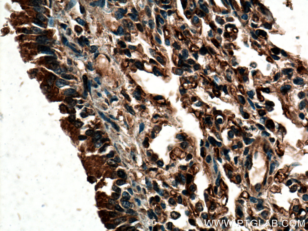 IHC staining of human lung using 24743-1-AP
