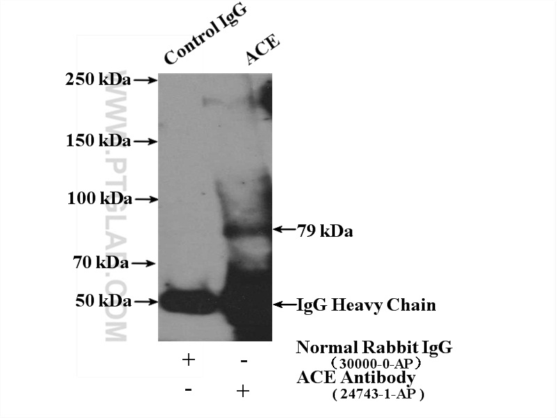 IP experiment of mouse heart using 24743-1-AP