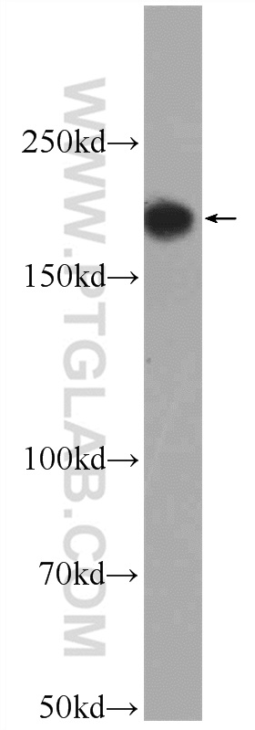 WB analysis of mouse heart using 24743-1-AP