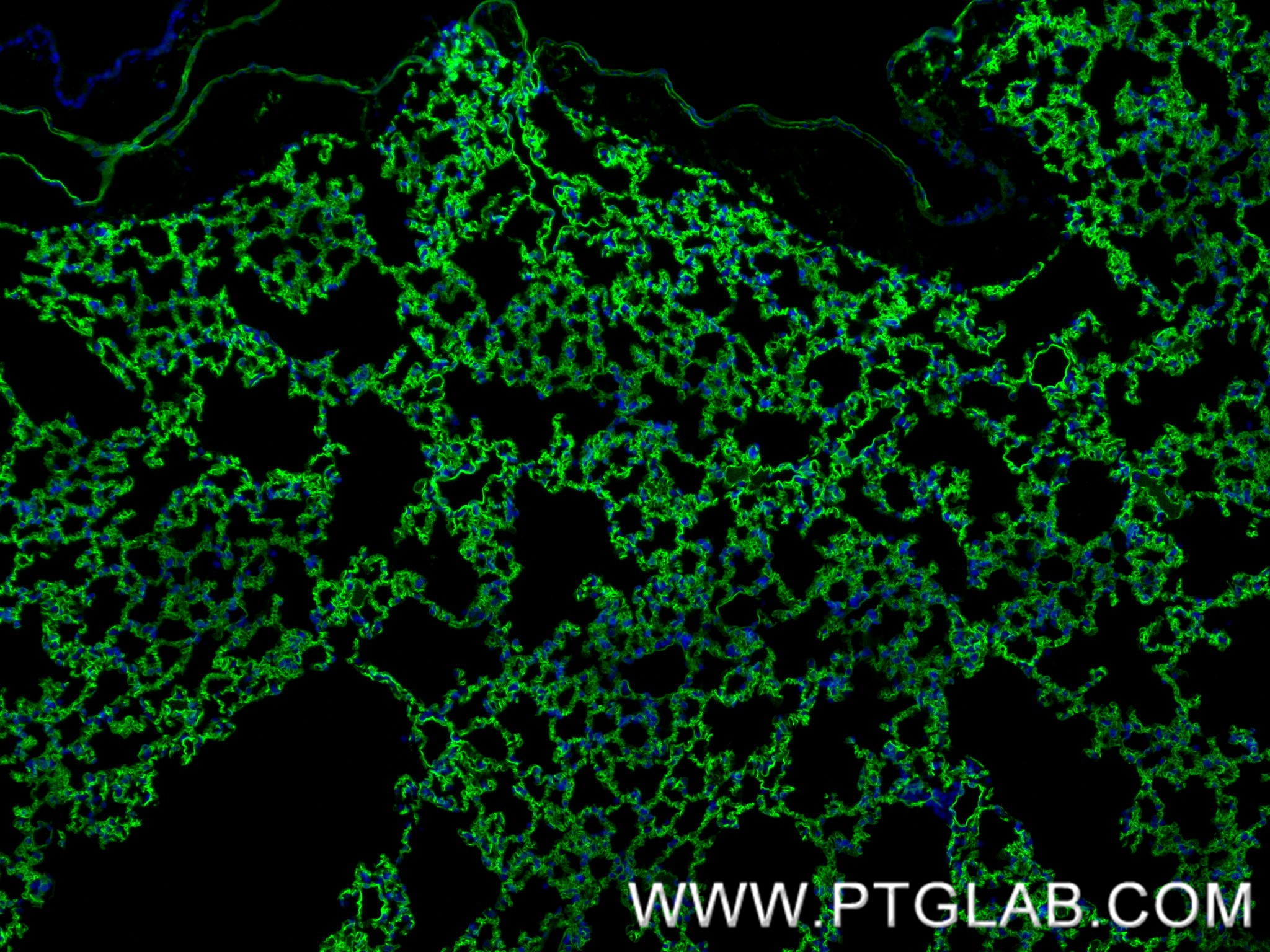IF Staining of mouse lung using 84407-4-RR