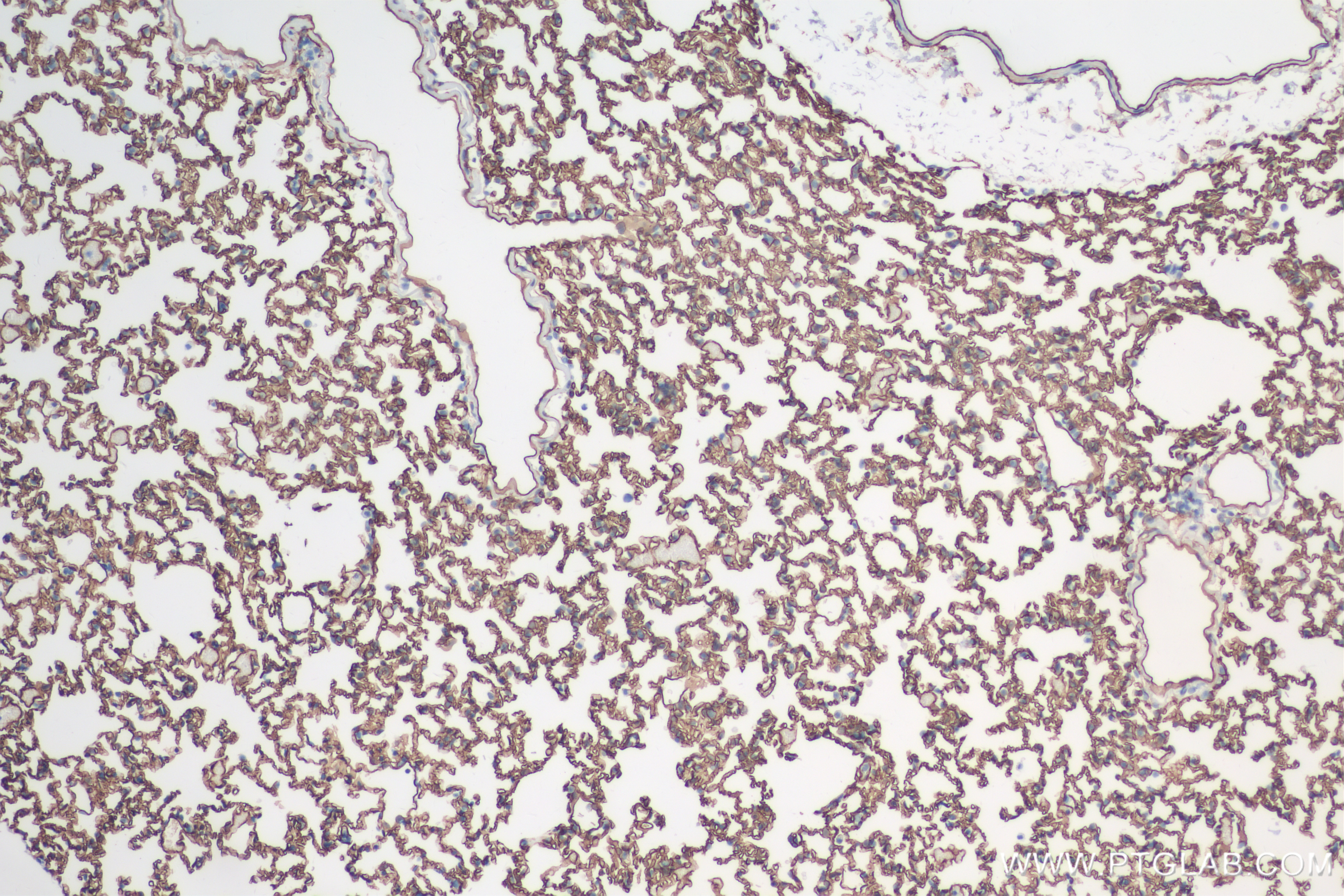 IHC staining of rat lung using 84407-4-RR (same clone as 84407-4-PBS)