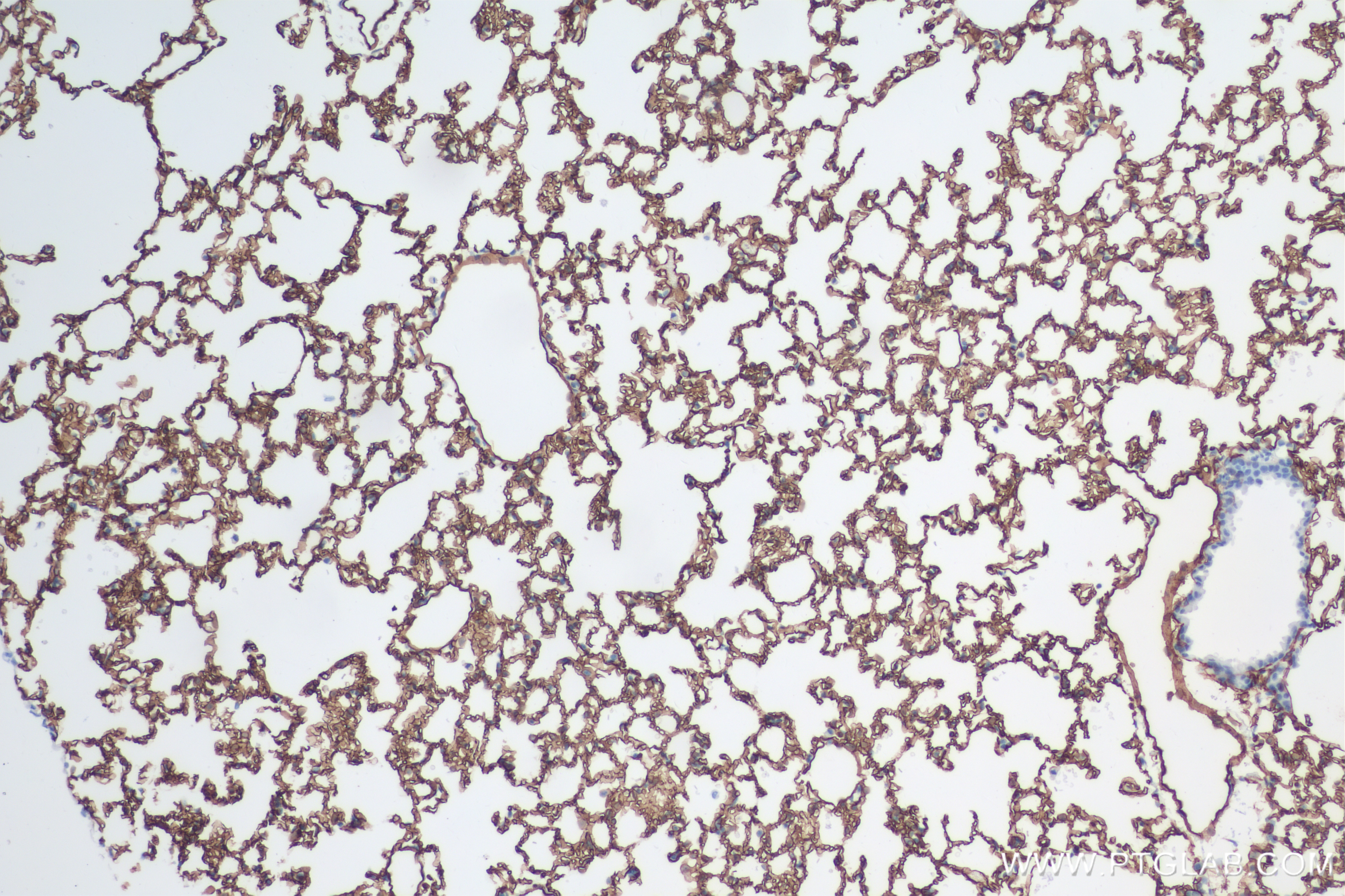 IHC staining of mouse lung using 84407-4-RR (same clone as 84407-4-PBS)