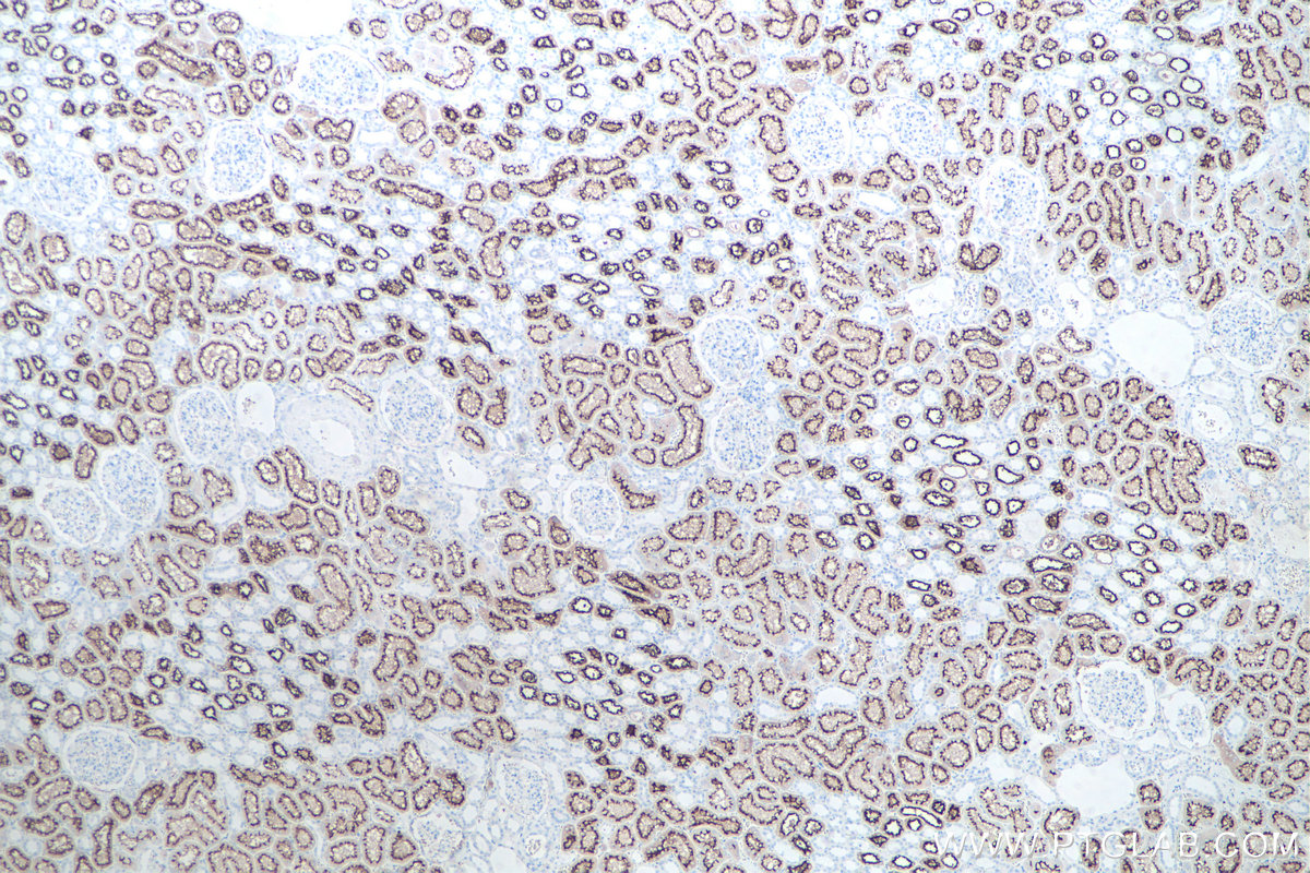 IHC staining of human kidney using 21115-1-AP