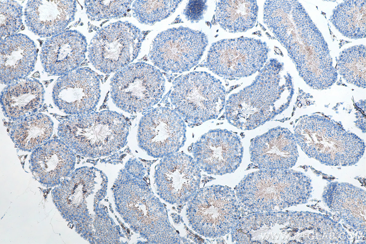 IHC staining of mouse testis using 21115-1-AP