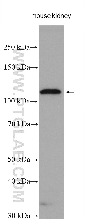 WB analysis using 21115-1-AP