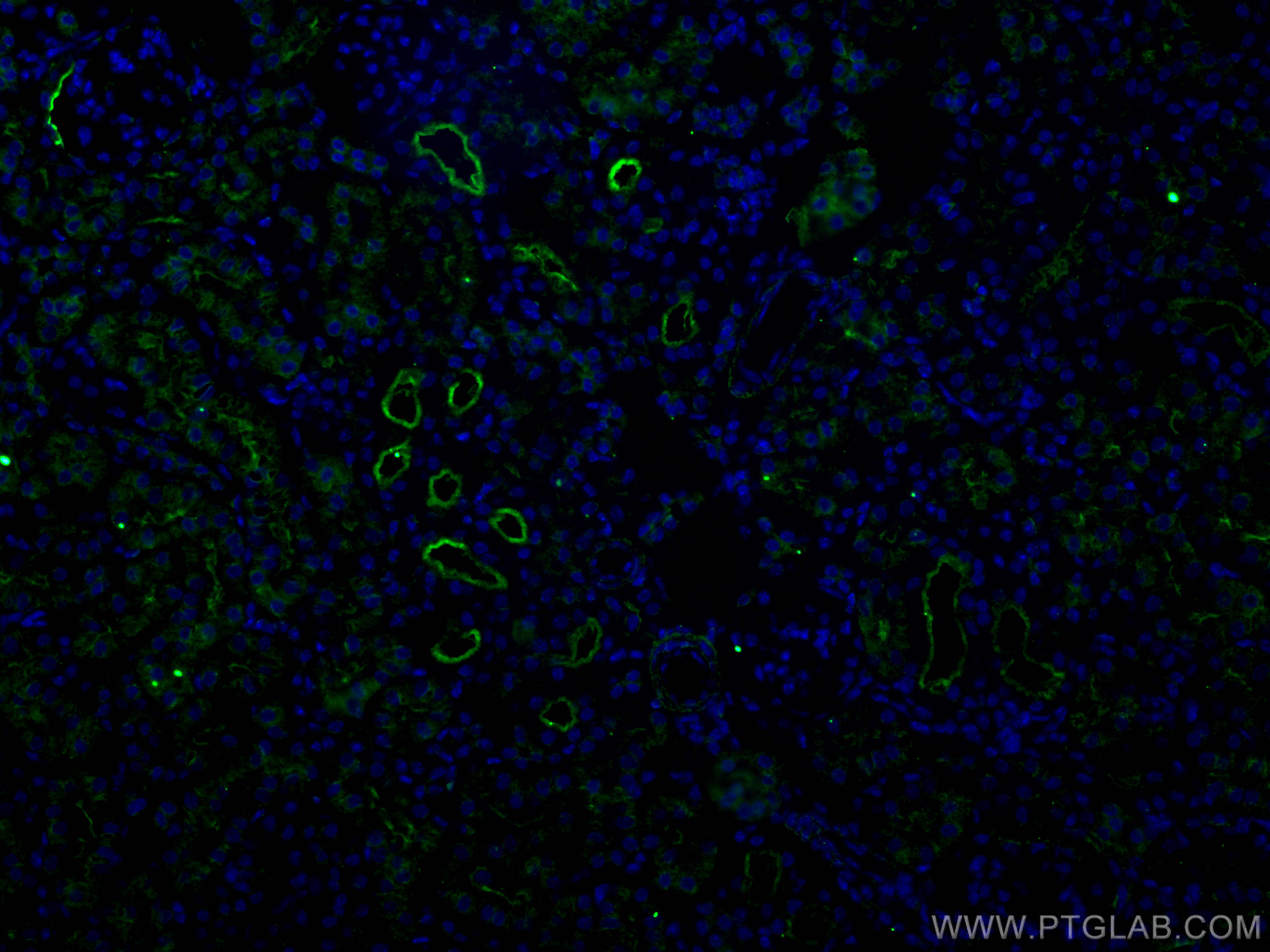 IF Staining of mouse kidney using 28868-1-AP