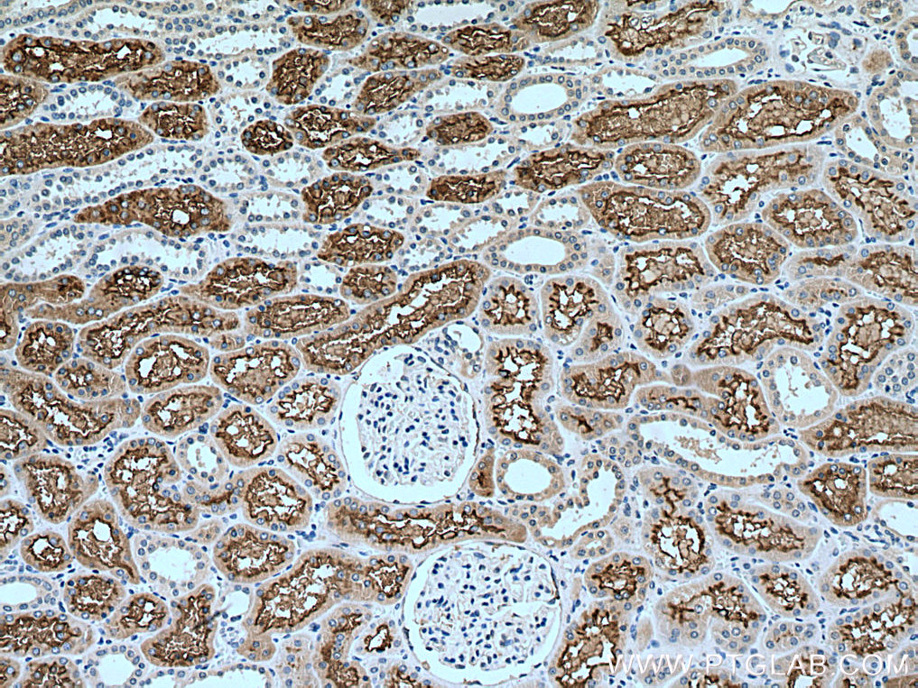 IHC staining of human kidney using 28868-1-AP