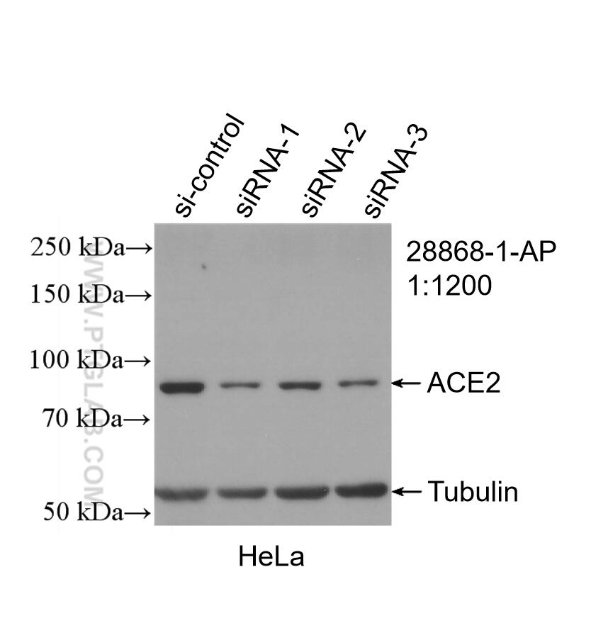 WB analysis of HeLa using 28868-1-AP