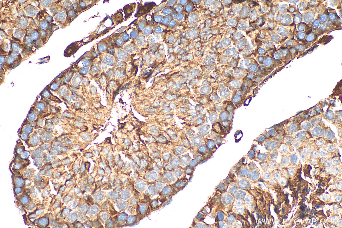 IHC staining of mouse testis using 31518-1-AP