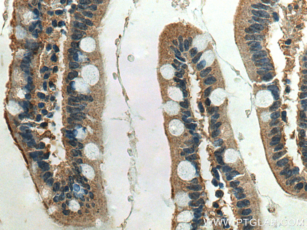 IHC staining of human small intestine using 66699-1-Ig