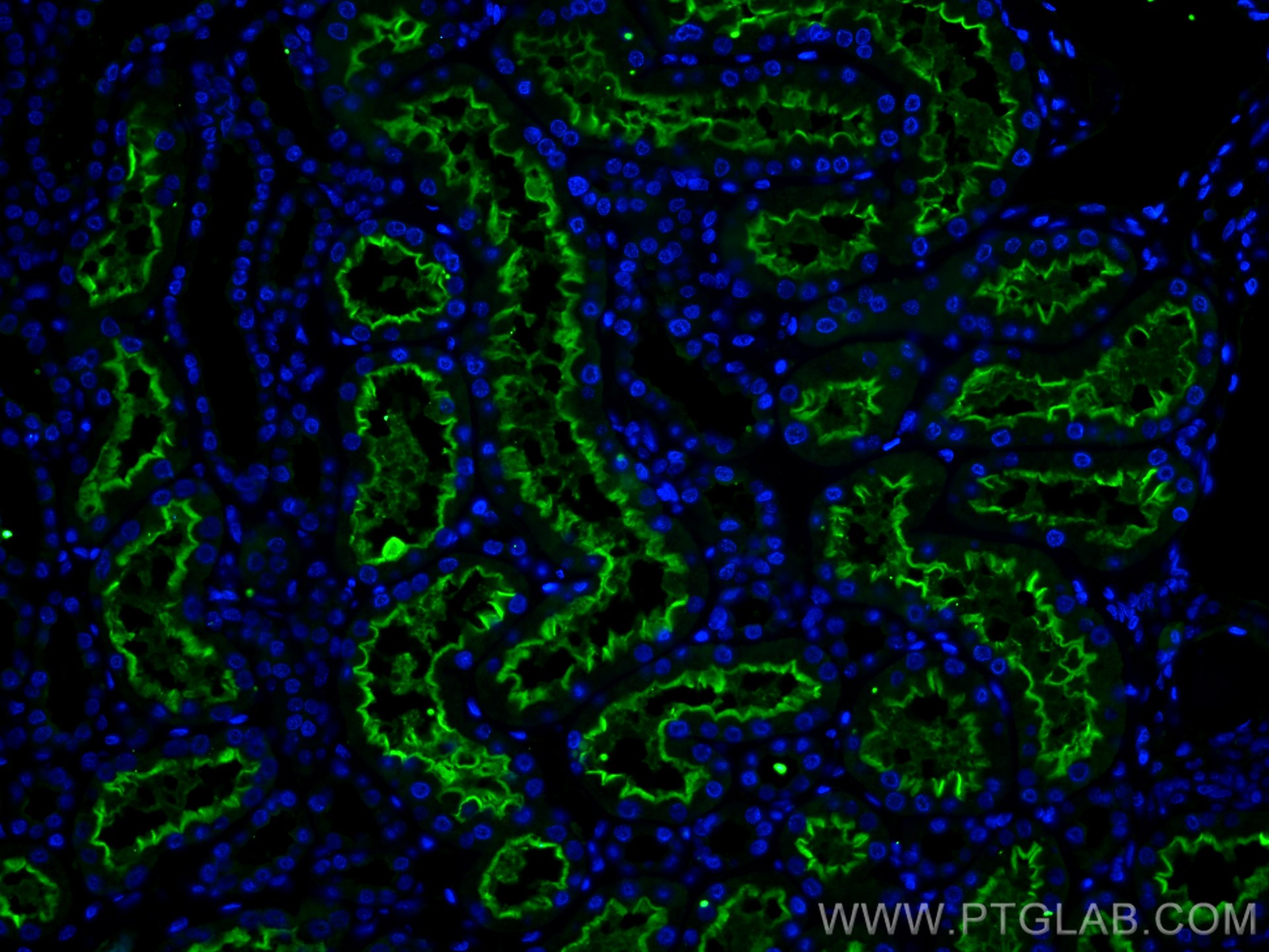 IF Staining of human kidney using 80063-1-RR