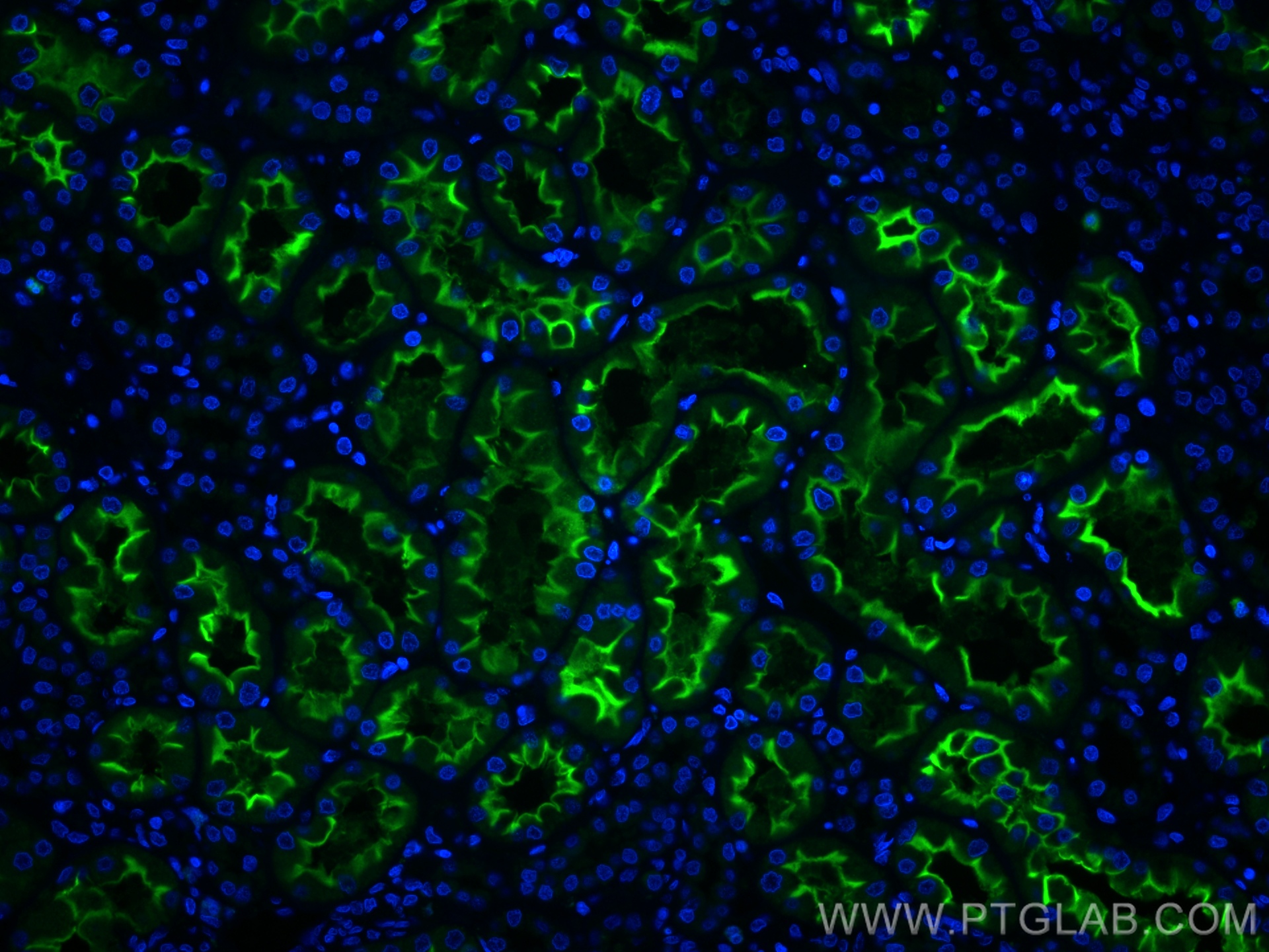 IF Staining of human kidney using CL488-66699