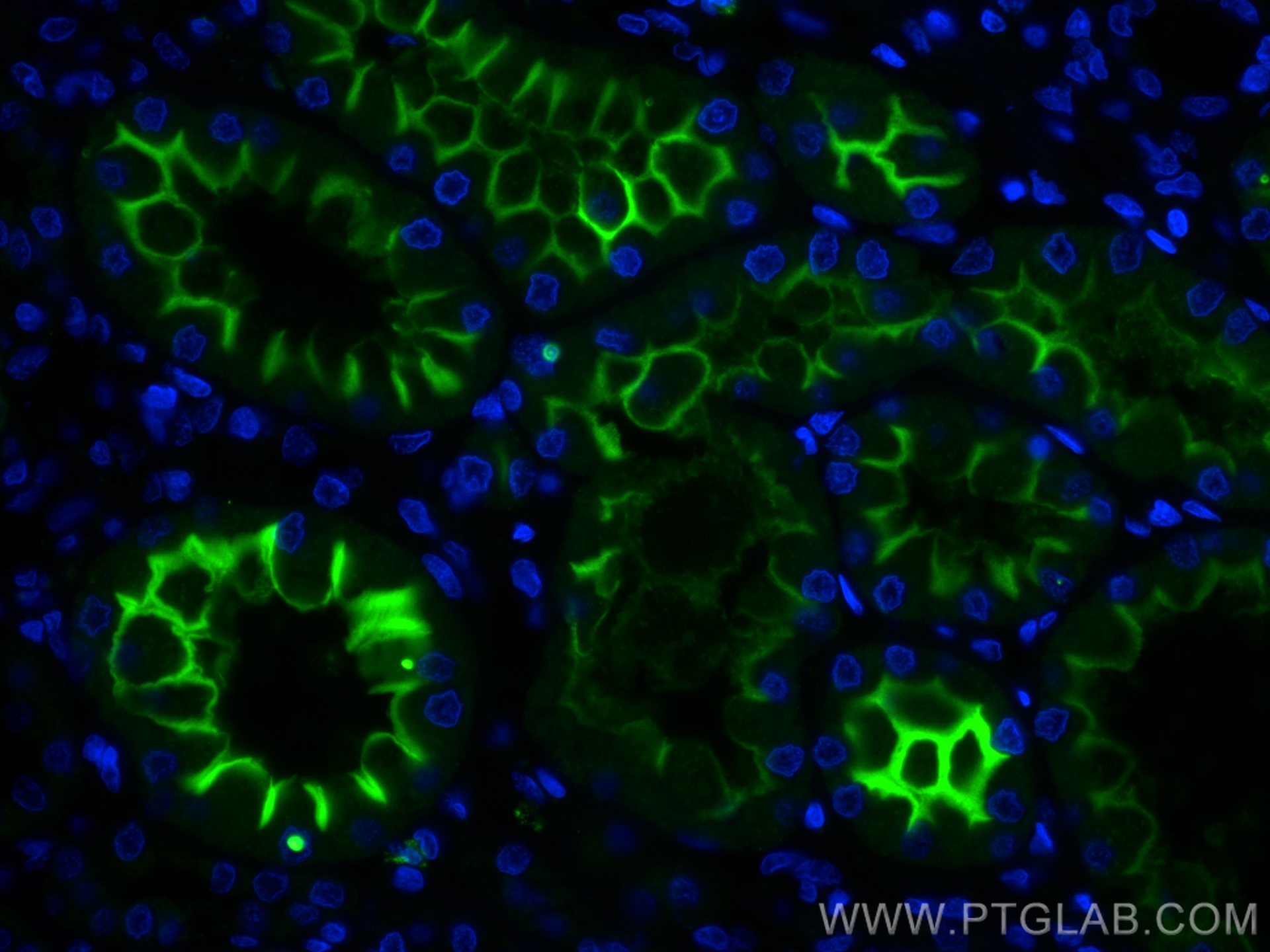 IF Staining of human kidney using CL488-66699