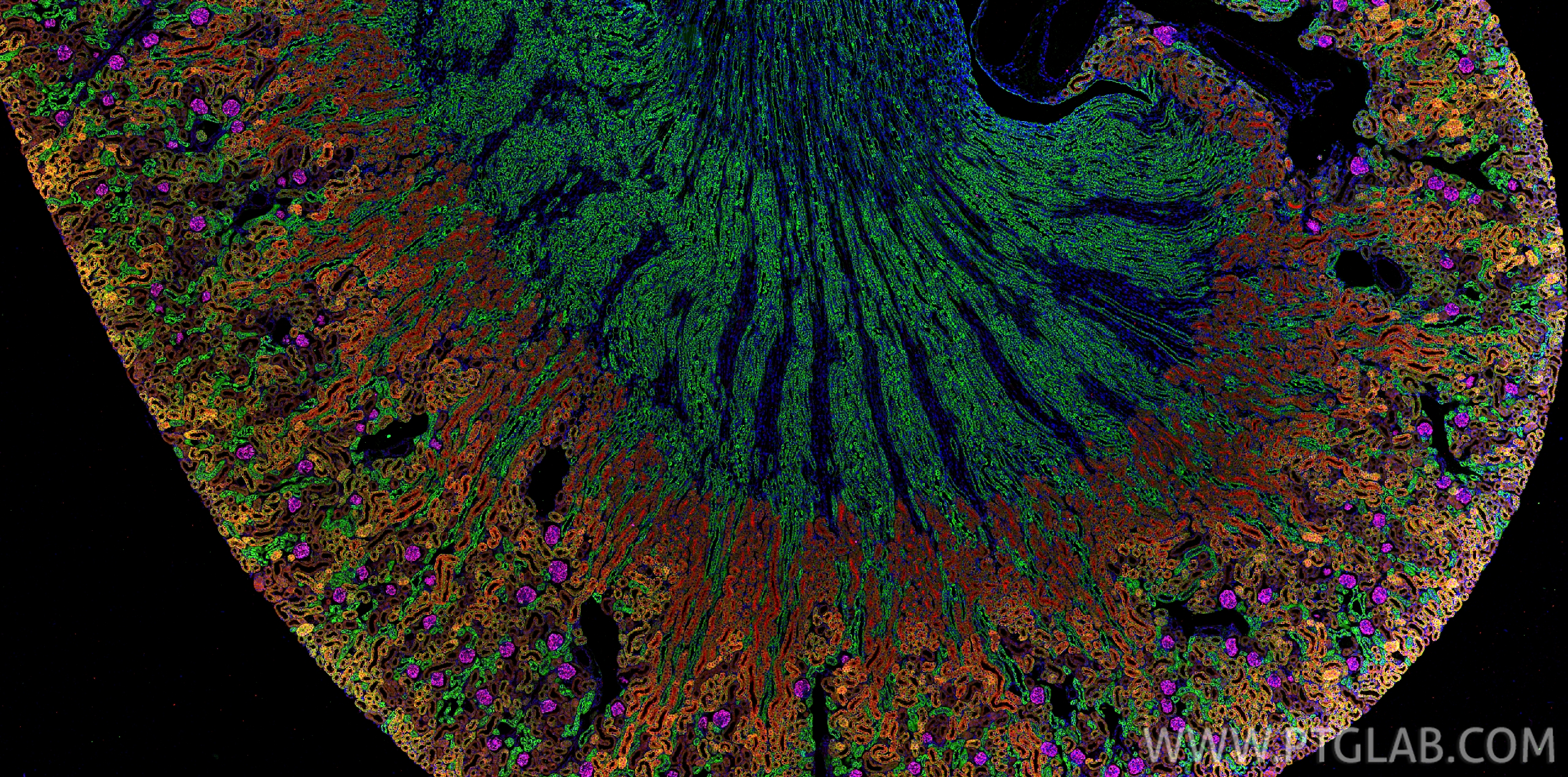IF Staining of mouse kidney using CL594-21115