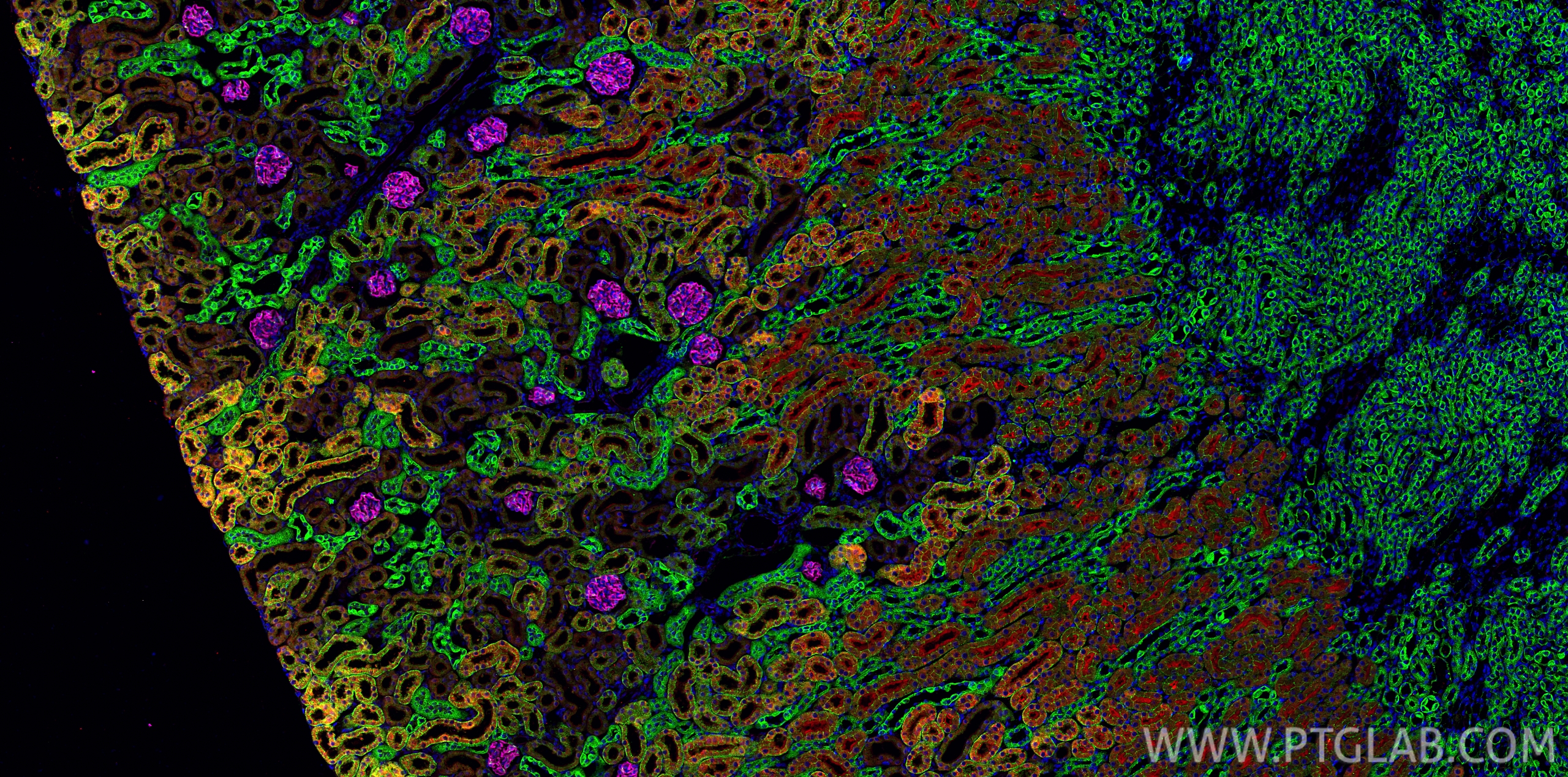 IF Staining of mouse kidney using CL594-21115