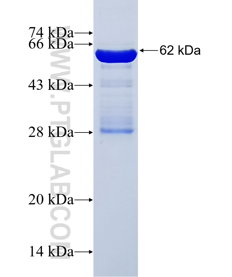 ACE2 fusion protein Ag30686 SDS-PAGE