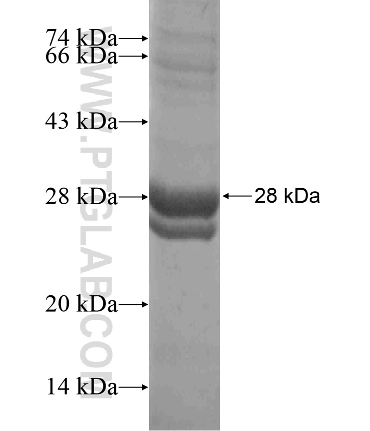 ACER1 fusion protein Ag18488 SDS-PAGE ACER1 fusion protein Ag18488 SDS-PAGE