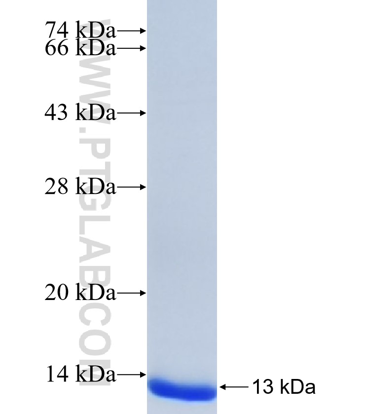 ACER2 fusion protein Ag34388 SDS-PAGE ACER2 fusion protein Ag34388 SDS-PAGE