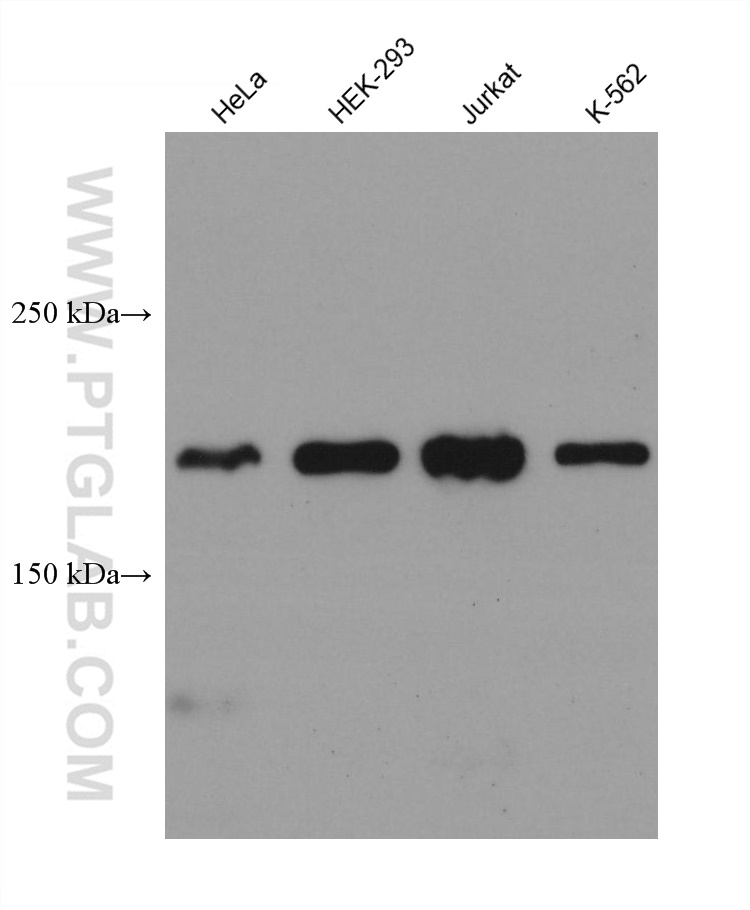 WB analysis using 67947-1-Ig