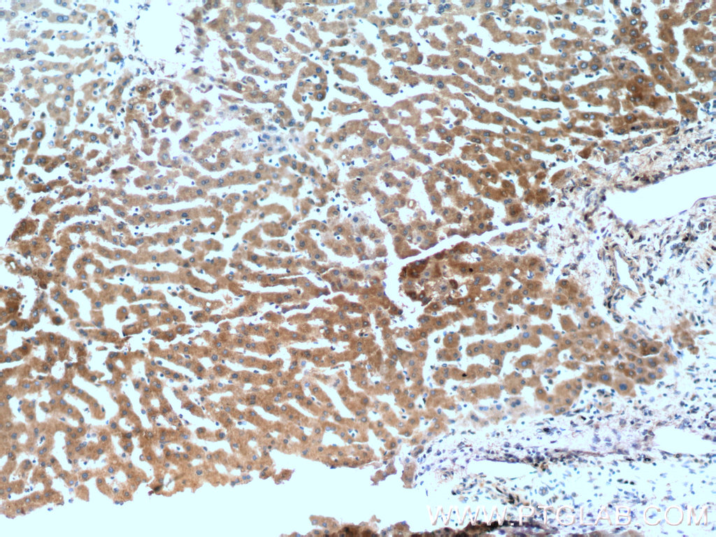 IHC staining of human liver using 17975-1-AP