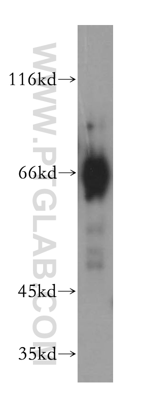 WB analysis of mouse liver using 17975-1-AP