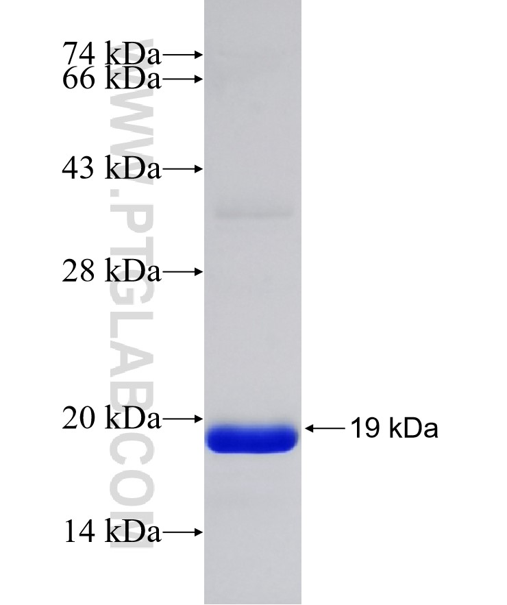 ACHE fusion protein Ag32412 SDS-PAGE ACHE fusion protein Ag32412 SDS-PAGE