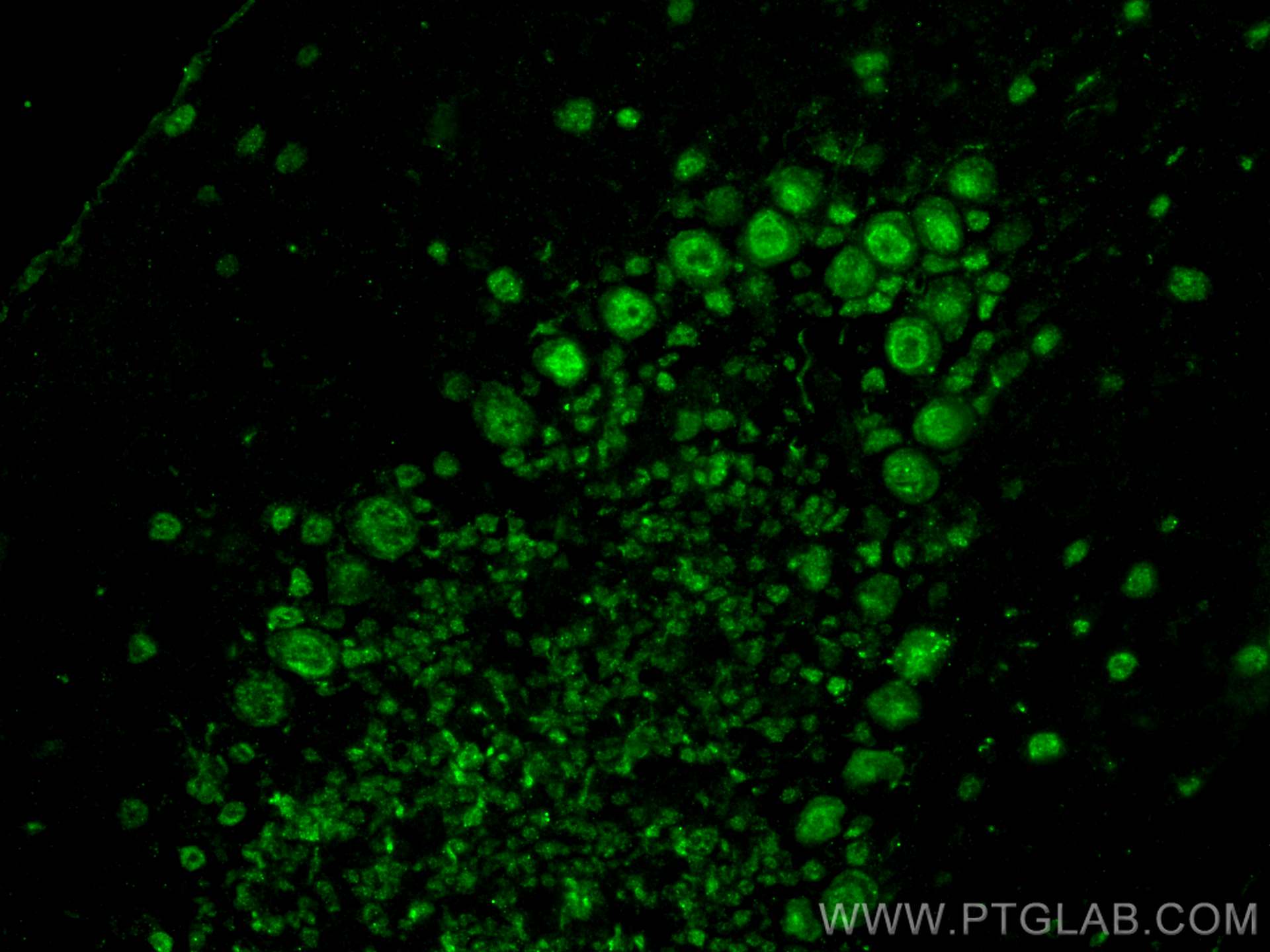IF Staining of mouse cerebellum using 30522-1-AP