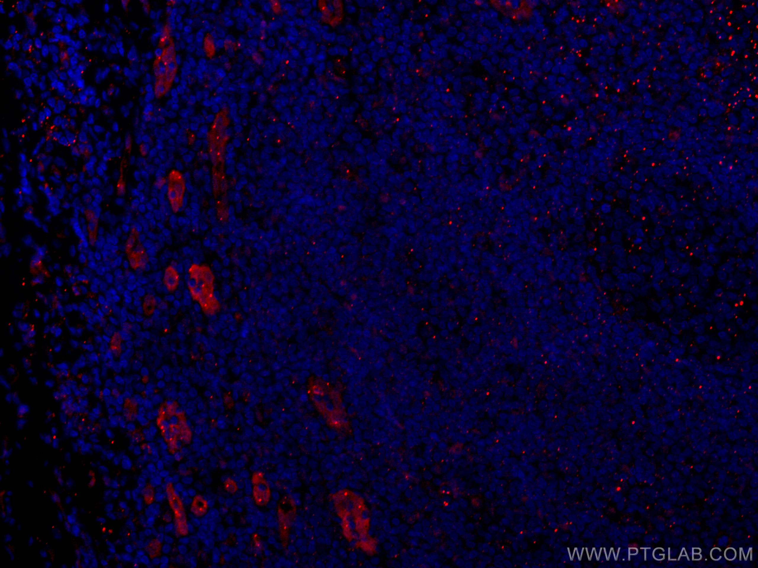 IF Staining of human tonsillitis using CL594-60046