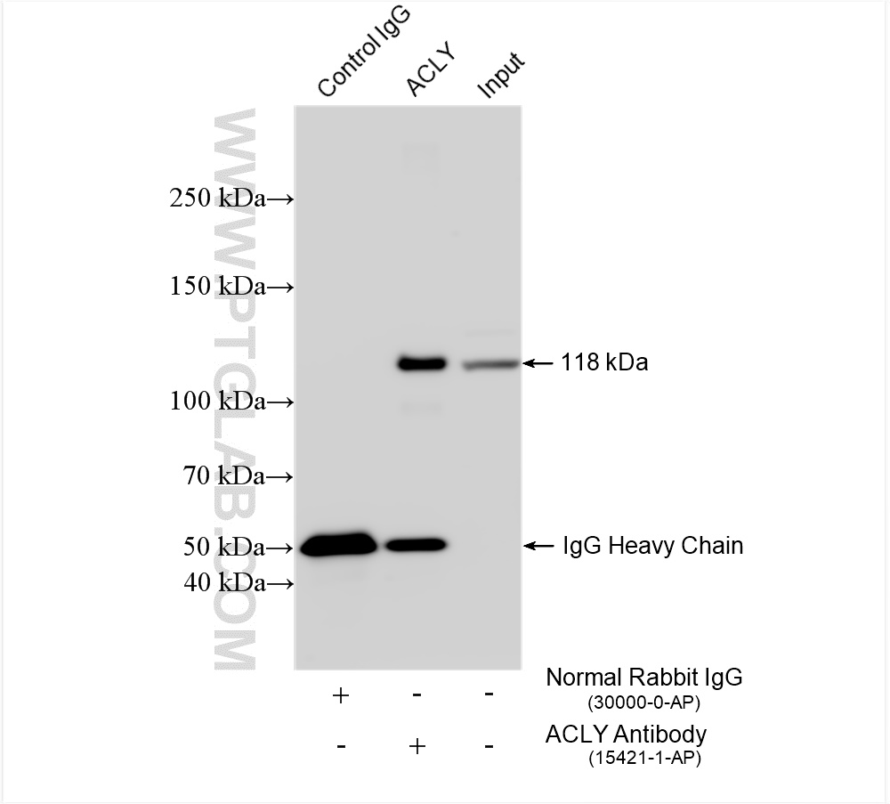 IP experiment of HeLa using 15421-1-AP