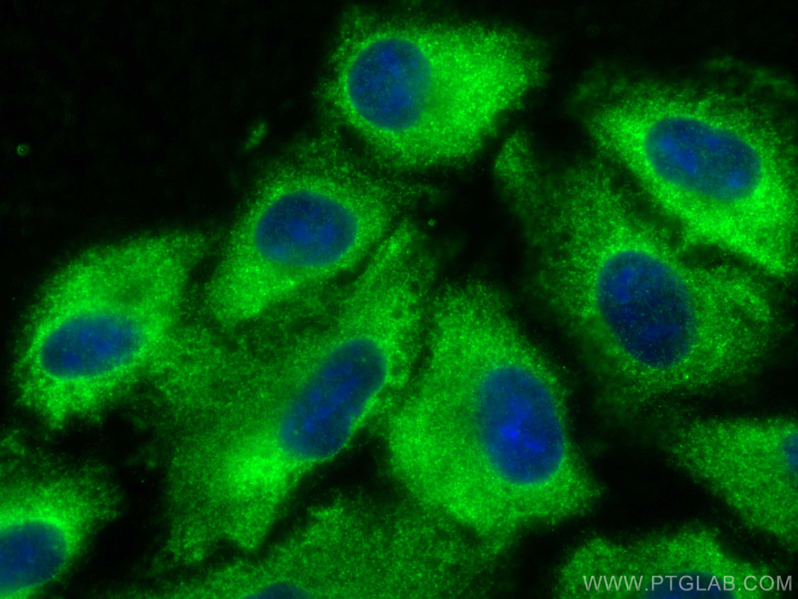 IF Staining of A549 using 67166-1-Ig