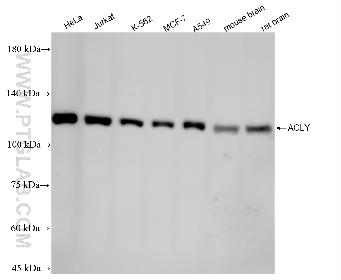WB analysis using 87231-1-RR (same clone as 87231-1-PBS) WB analysis using 87231-1-RR (same clone as 87231-1-PBS)