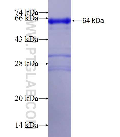 ACLY fusion protein Ag7709 SDS-PAGE