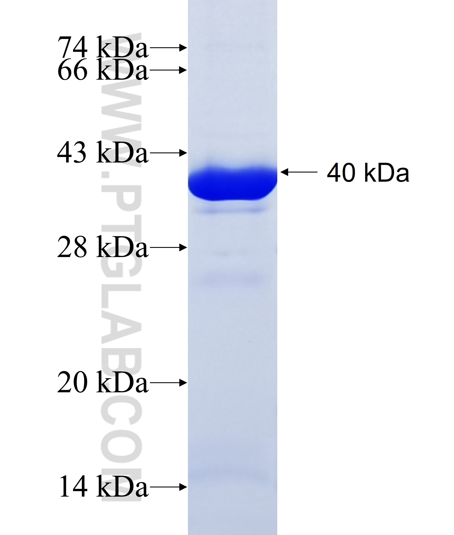 ACLY fusion protein Ag7940 SDS-PAGE