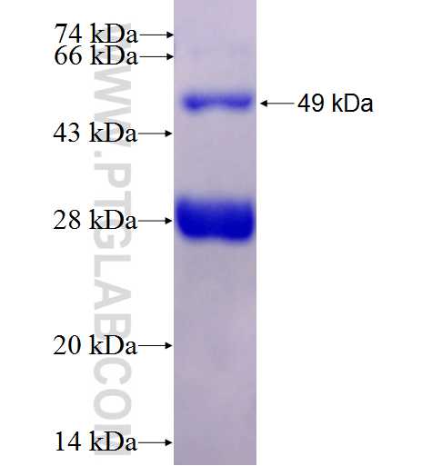 ACMSD fusion protein Ag25212 SDS-PAGE