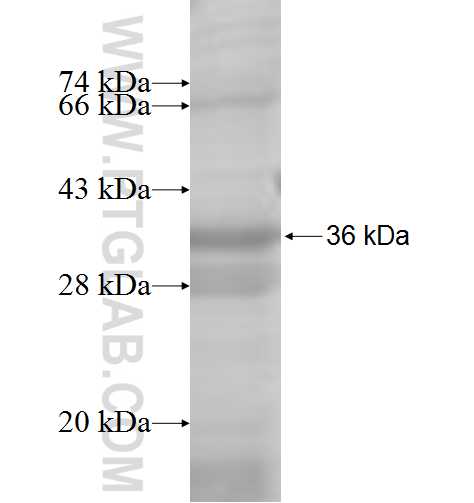ACMSD fusion protein Ag7994 SDS-PAGE ACMSD fusion protein Ag7994 SDS-PAGE