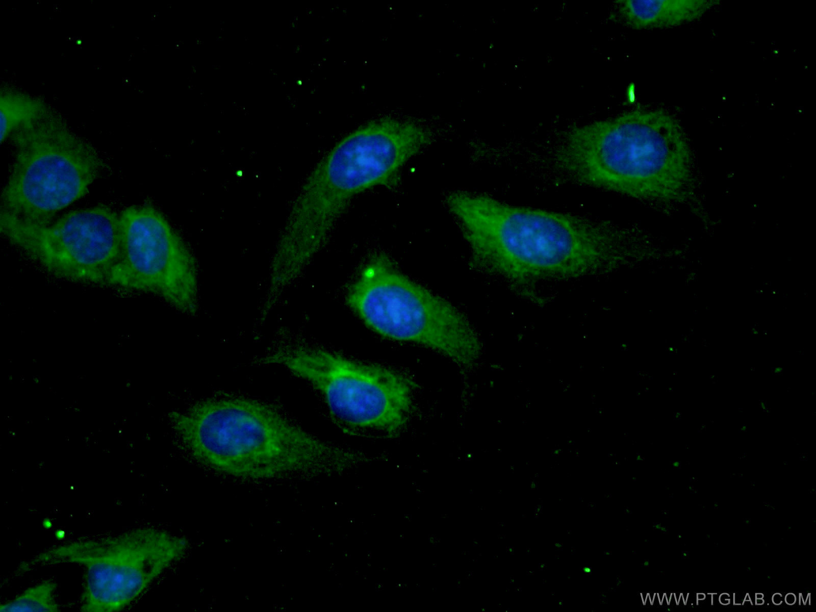 IF Staining of U2OS using 12406-1-AP