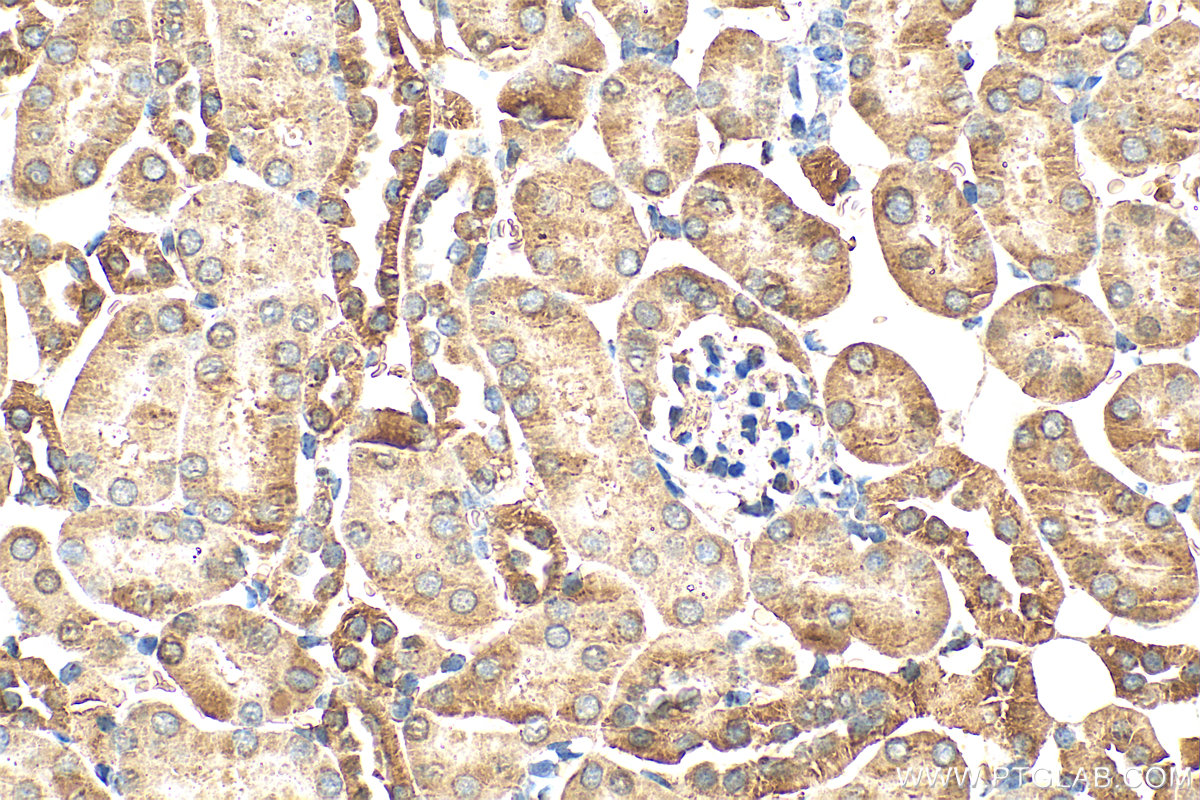 IHC staining of mouse kidney using 11134-1-AP