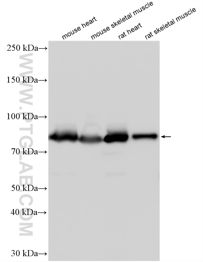 Various lysates were subjected to SDS PAGE followed by western blot with 11134-1-AP (Aconitase 2 antibody) at dilution of 1:15000 incubated at room temperature for 1.5 hours. WB analysis using 11134-1-AP