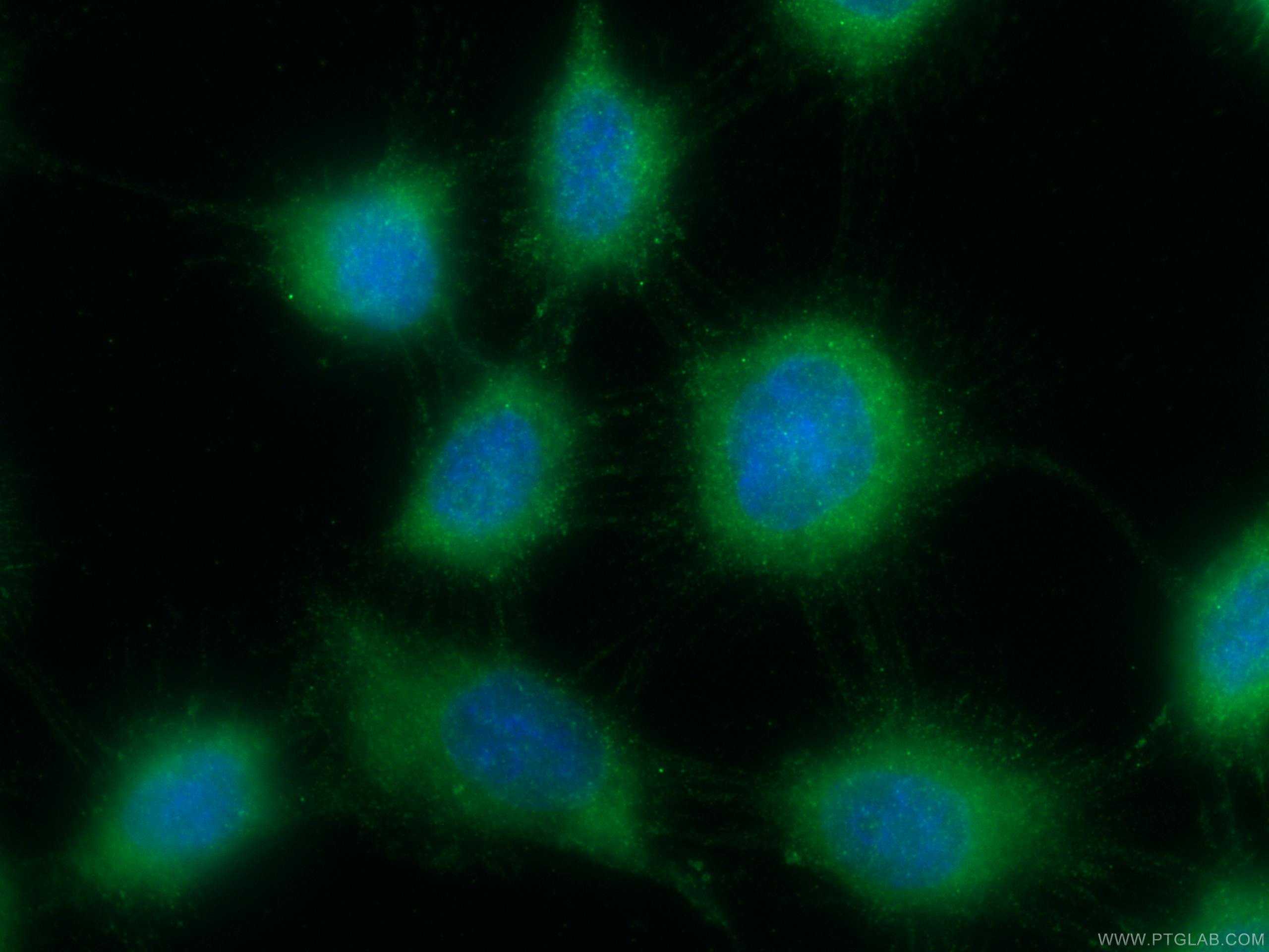 IF Staining of A431 using 10776-1-AP