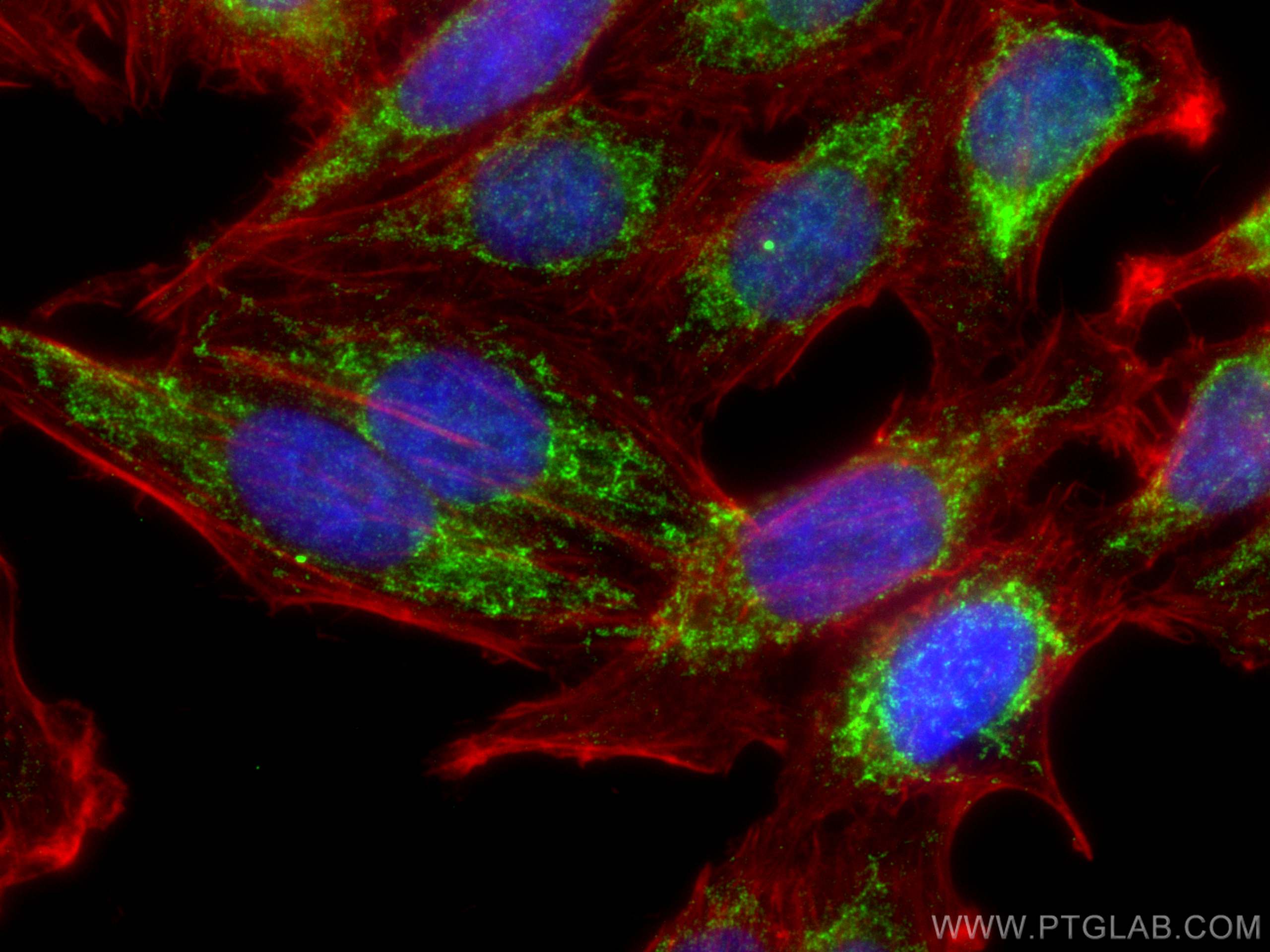 IF Staining of HepG2 using 15633-1-AP