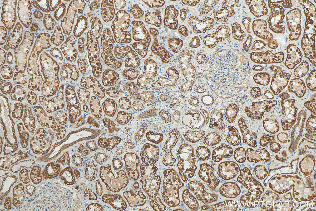 IHC staining of human kidney using 15633-1-AP