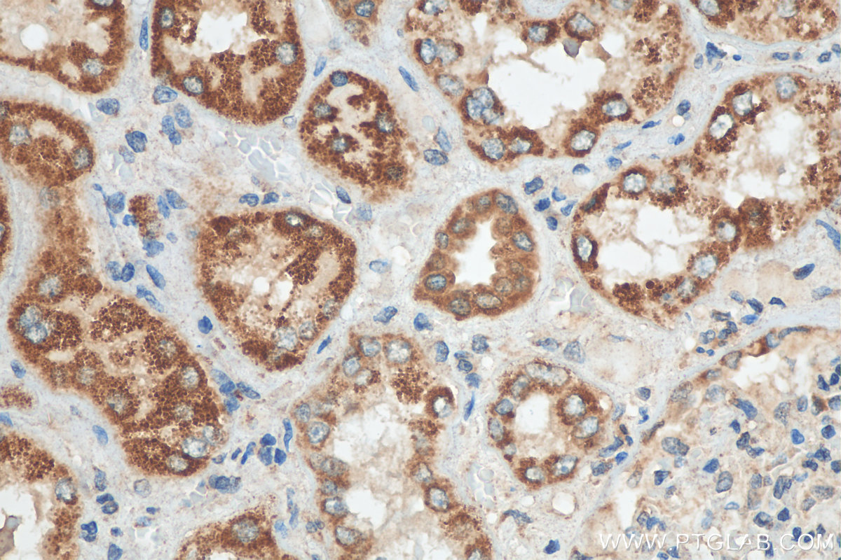 IHC staining of human kidney using 15633-1-AP