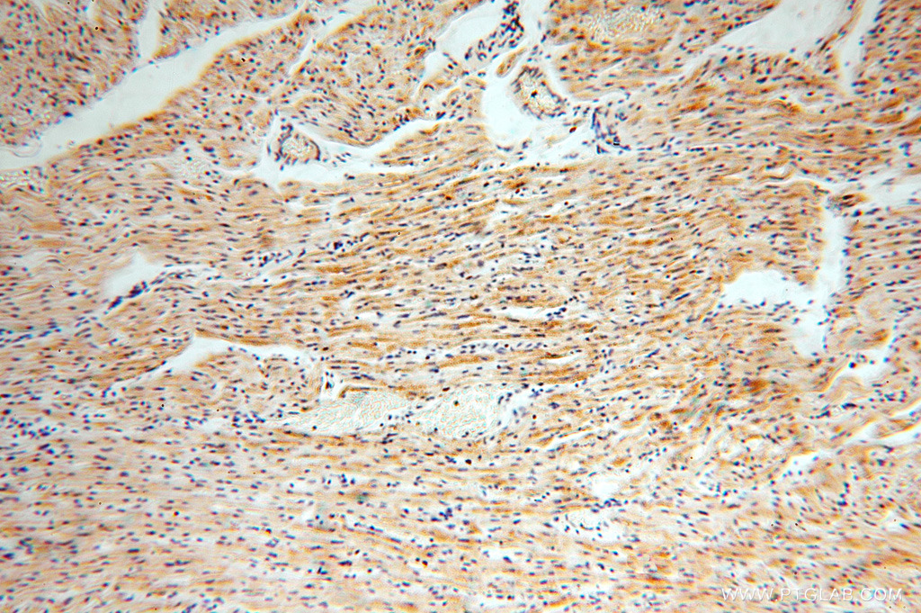 IHC staining of human heart using 15633-1-AP