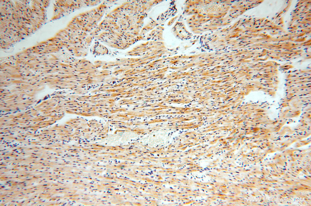 IHC staining of human heart using 15633-1-AP