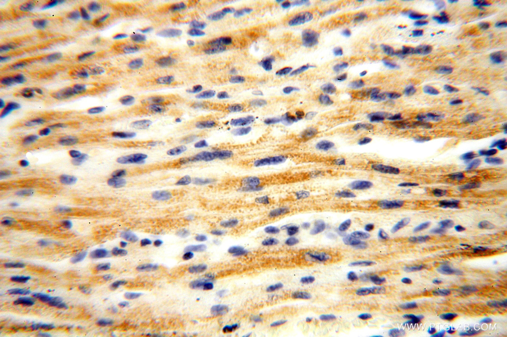 IHC staining of human heart using 15633-1-AP